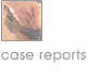 Case reports