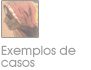 Exemplos de casos
