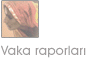 Vaka raporları