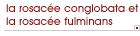 la rosac�e conglobata et la rosac�e fulminans