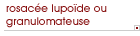 rosac�e lupo�de ou granulomateuse