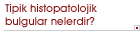 Tipik histopatolojik bulgular nelerdir?